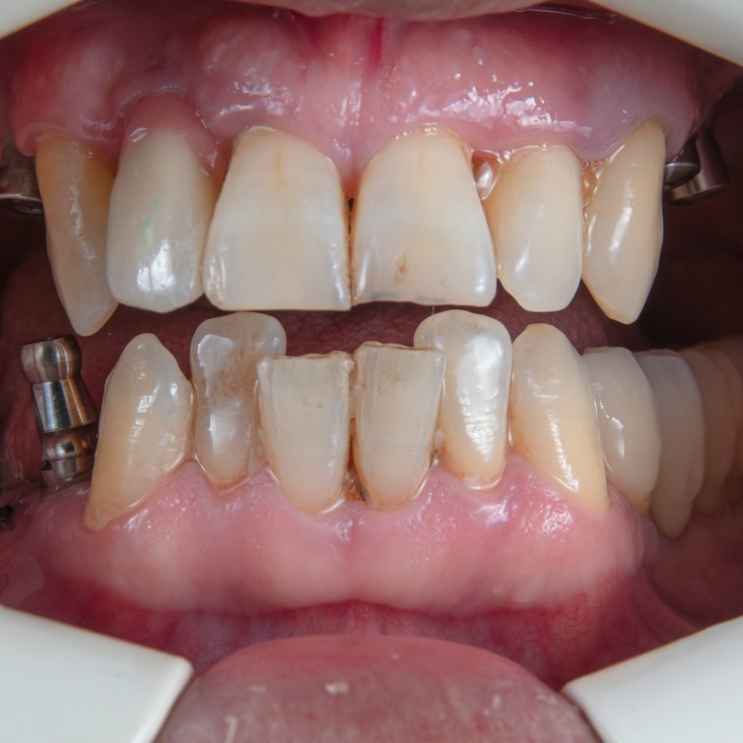 a person's mouth with teeth and tongue